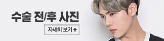 수술전후사진